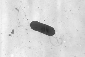 This 2002 electron microscope image made available by the Centers for Disease Control and Prevention shows a Listeria monocytogenes bacterium, responsible for the food borne illness listeriosis. On Wednesday, Nov. 9, 2022, U.S. health officials said at least one death and a pregnancy loss are tied to an outbreak of listeria food poisoning associated with sliced deli meats and cheeses that has sickened 16 people in six states, including 13 who were hospitalized.