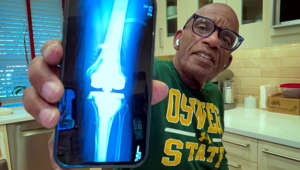 TODAY’s Al Roker gives an update on his recovery from knee surgery, saying it was his 