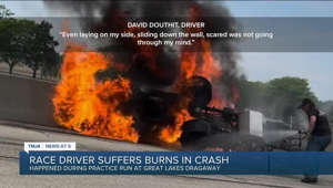Race driver suffers burns in crash