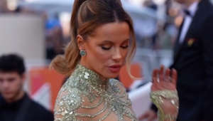 Kate Beckinsale responds to plastic surgery accusations