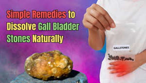 Simple Remedies to Dissolve Gall Bladder Stones Naturally