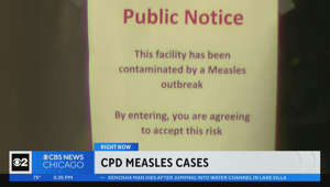 Apparent measles outbreak inside Chicago Police precinct