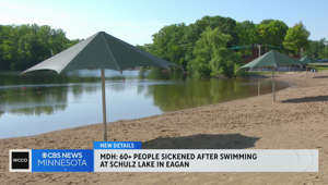 Outbreak at Schulze Lake in Eagan may be due to norovirus, experts say