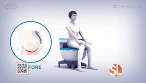 Esthetic Brilliance Med Spa offers a non-invasive solution for urinary incontinence that will improve your quality of life