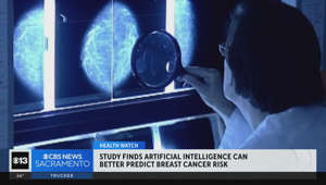 Study finds AI can better predict breast cancer risk