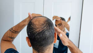 A new study from Northwestern University published in the journal PNAS this week suggests that there could be a way to prevent age-related baldness at the cellular level. The study points out that as people age, their hair follicles get stiff, comparing it to the way joints can get stiff as we age.