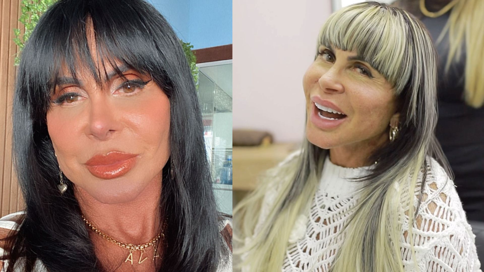 Gretchen é criticada por excesso de pelos