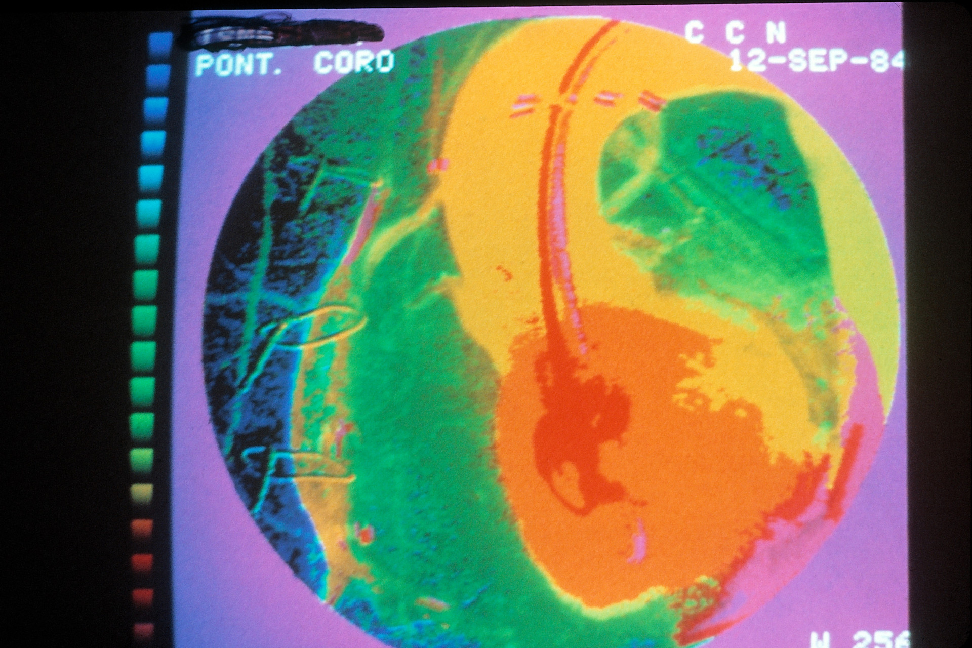 Las intervenciones quirúrgicas más arriesgadas del mundo