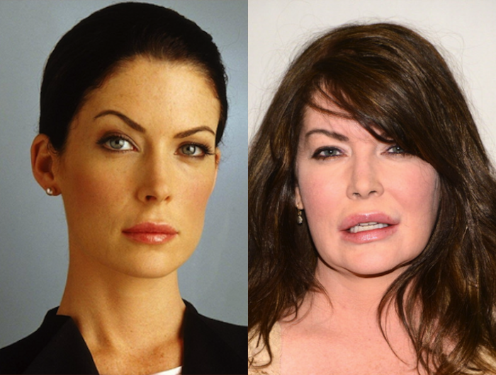 Celebs looked better without plastic