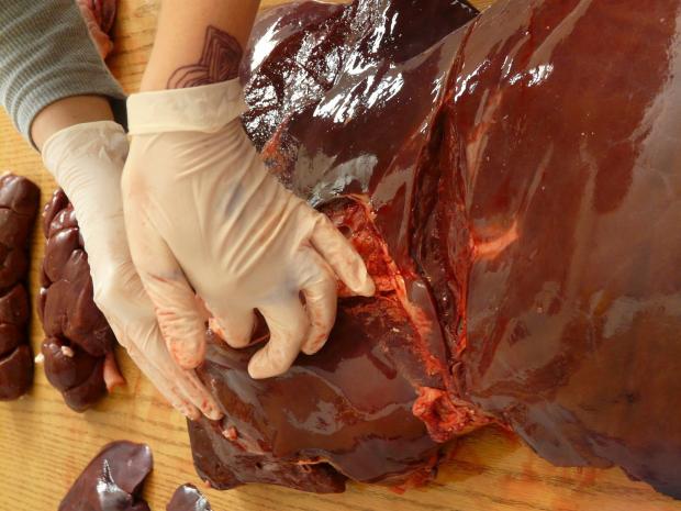 early signs your liver damaged