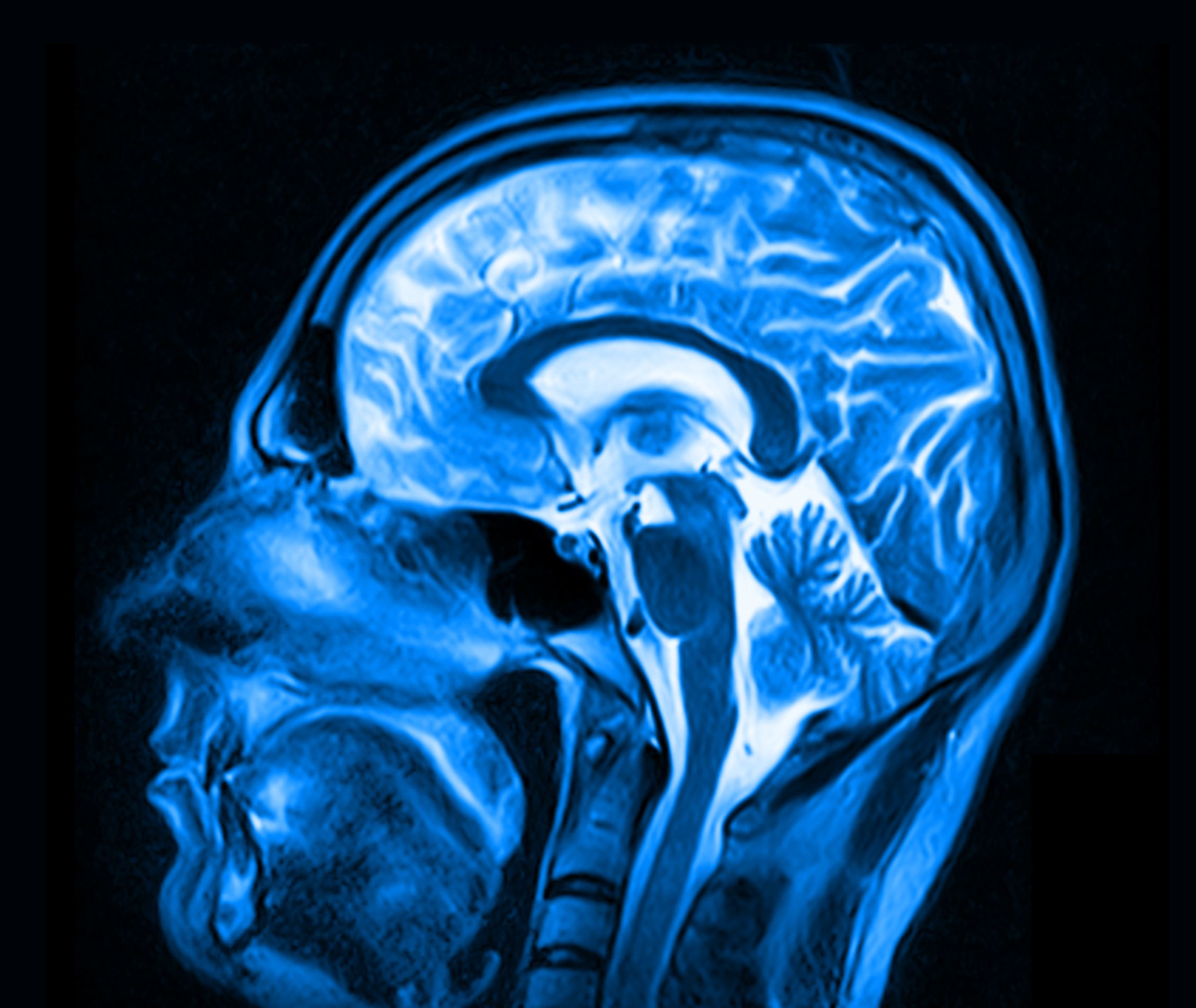 Scientists have found brainâ€™s switch'