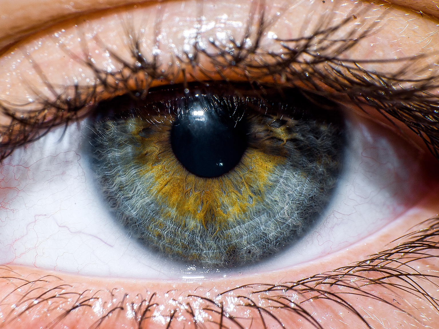 Warning signs your eyes send