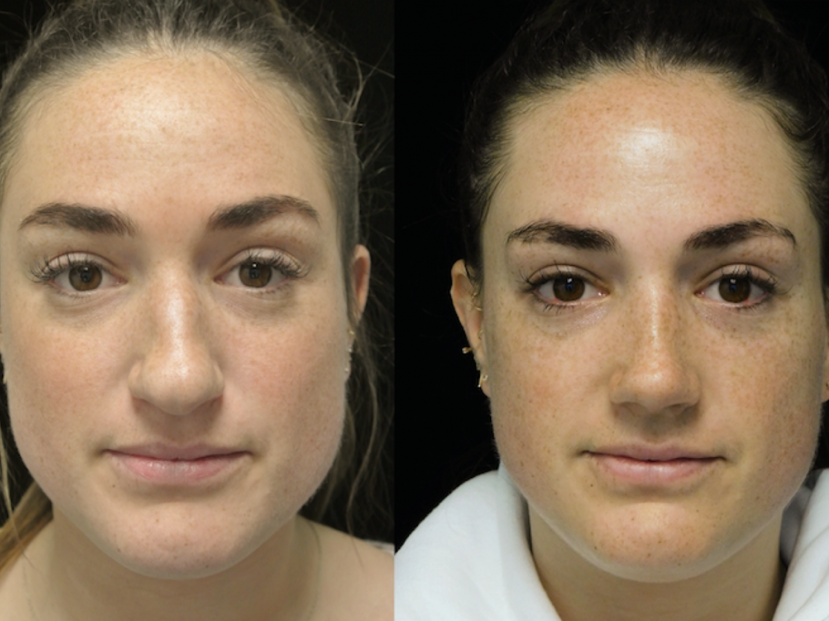 This woman's reason plastic surgery