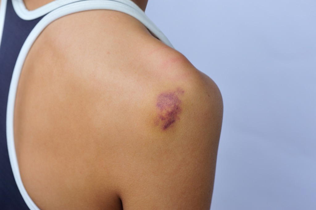 First sign liver damage
