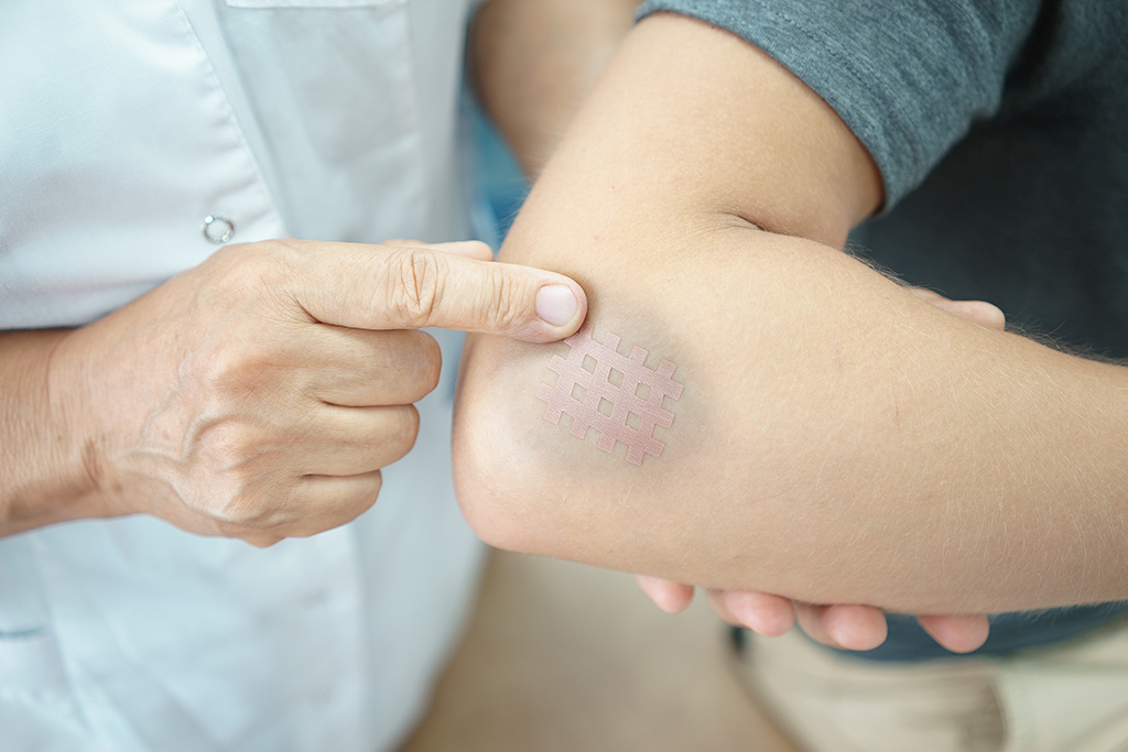 signs skin cancer other than