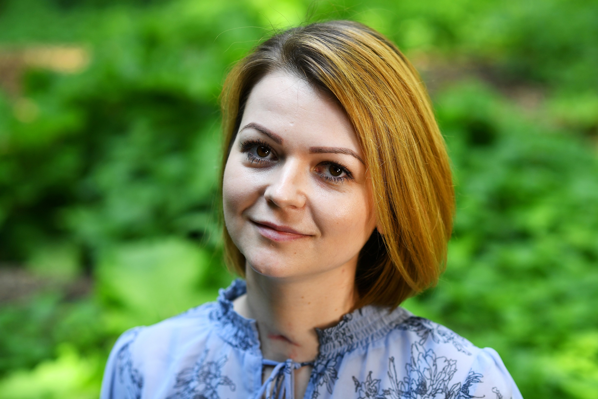 Russian ex-spy survive deadly nerve