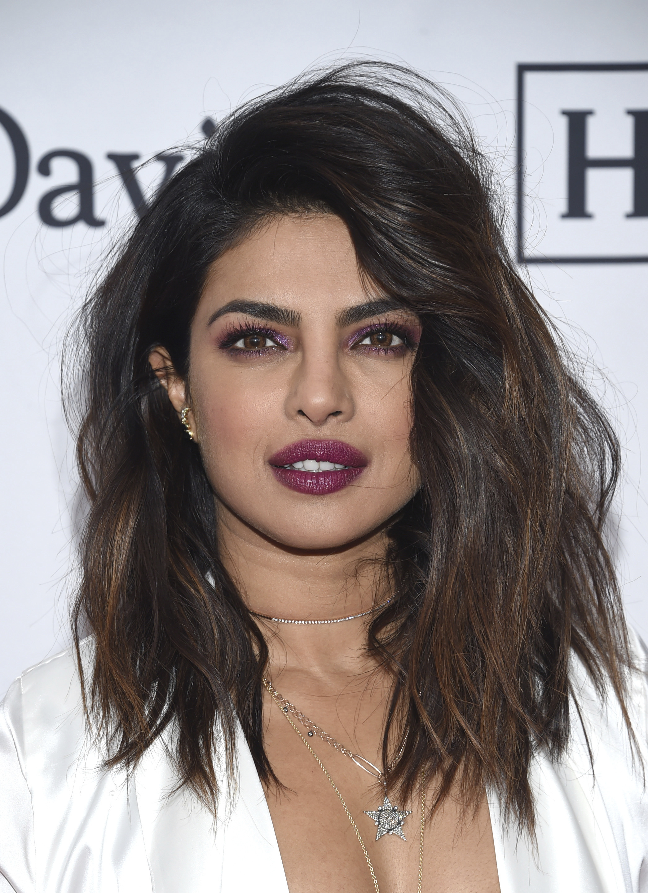 Priyanka Chopra 'hates' dental work,