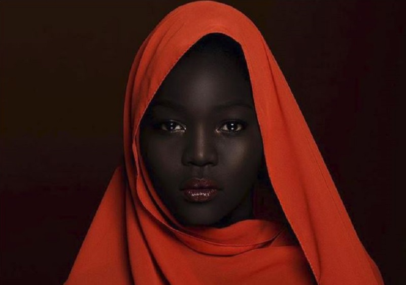Model told bleach dark skin