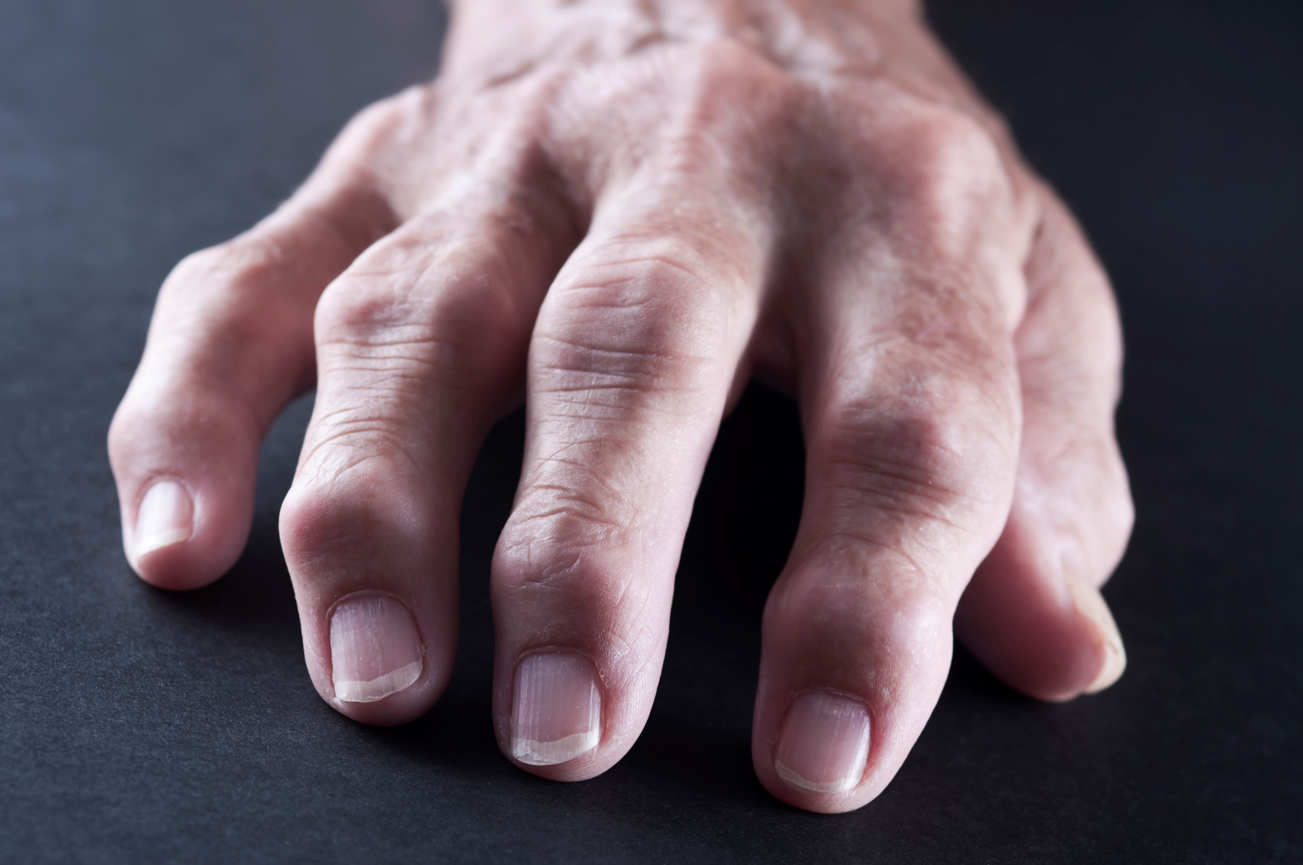 This vitamin supplement helps prevent