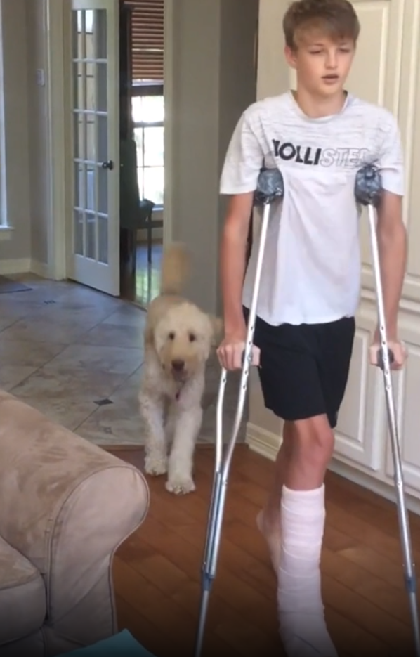 Dog hilariously mocks teenager's broken leg 'walk'