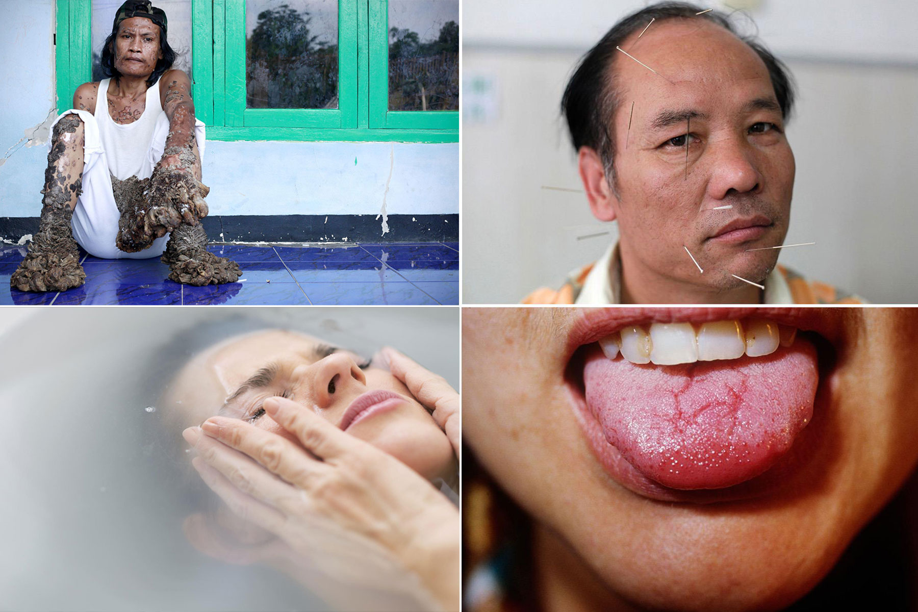 rare medical syndromes won't believe