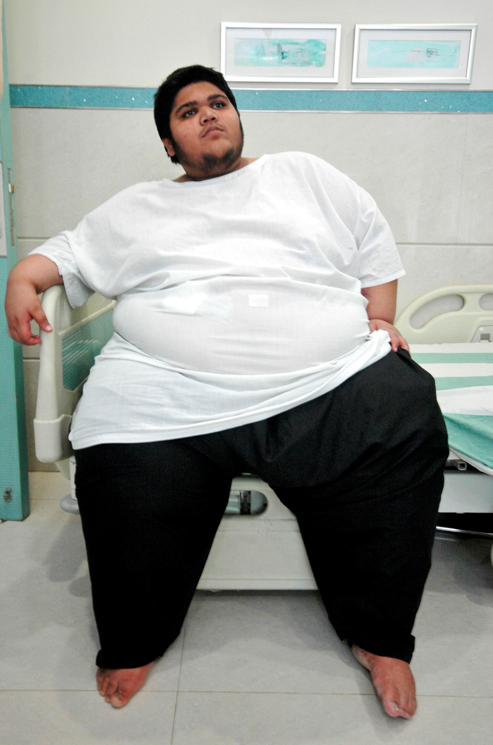 Vitamin Deficiency could consequence Obesity