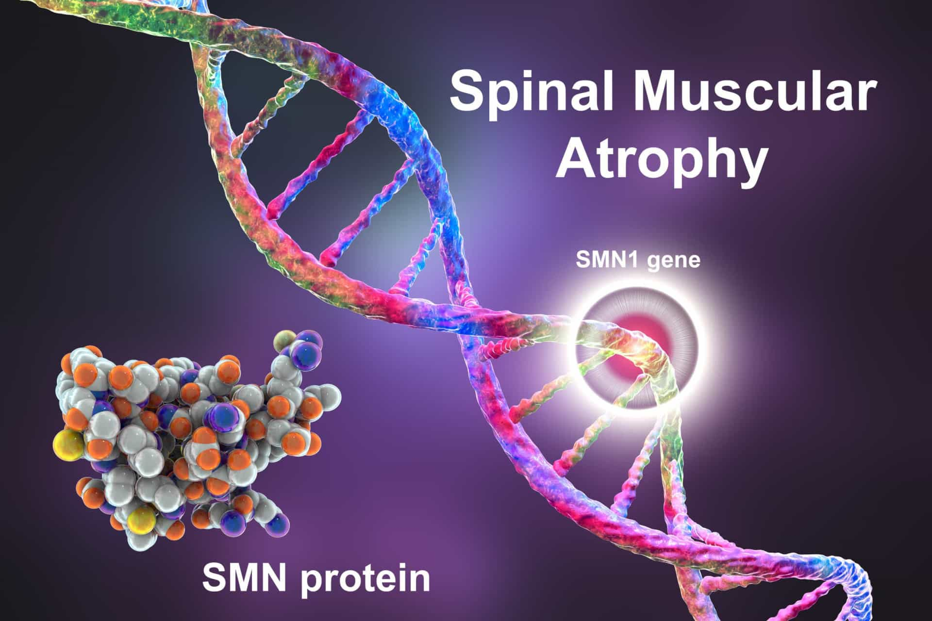 The Devastating Effects Of Spinal Muscular Atrophy 3234