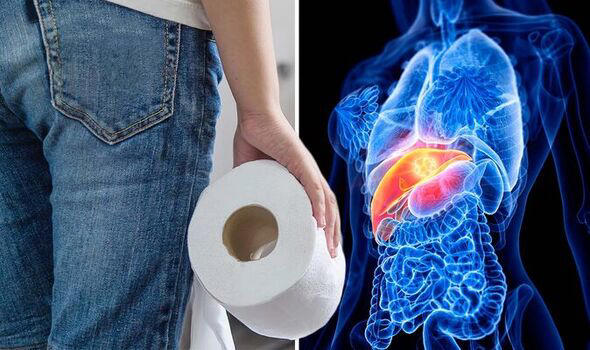 Liver disease: The 'early' warning signs include diarrhoea - 'Tell your doctor'.