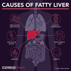 Unlike ARLD, fatty liver disease isn't caused by alcohol.