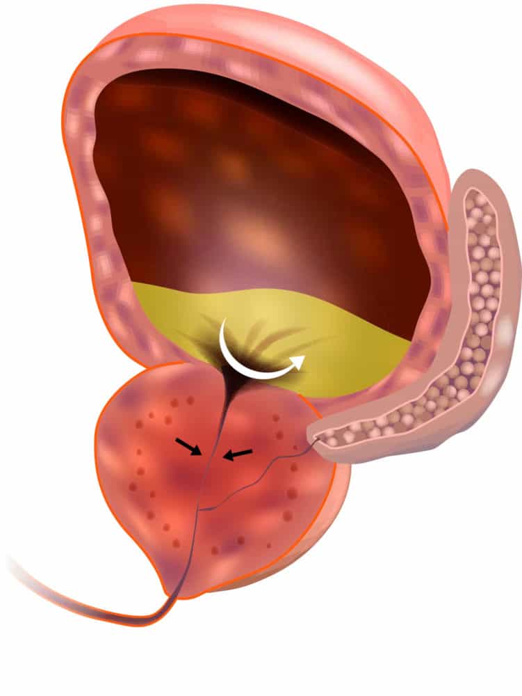 Worrying symptoms that men should always take seriously