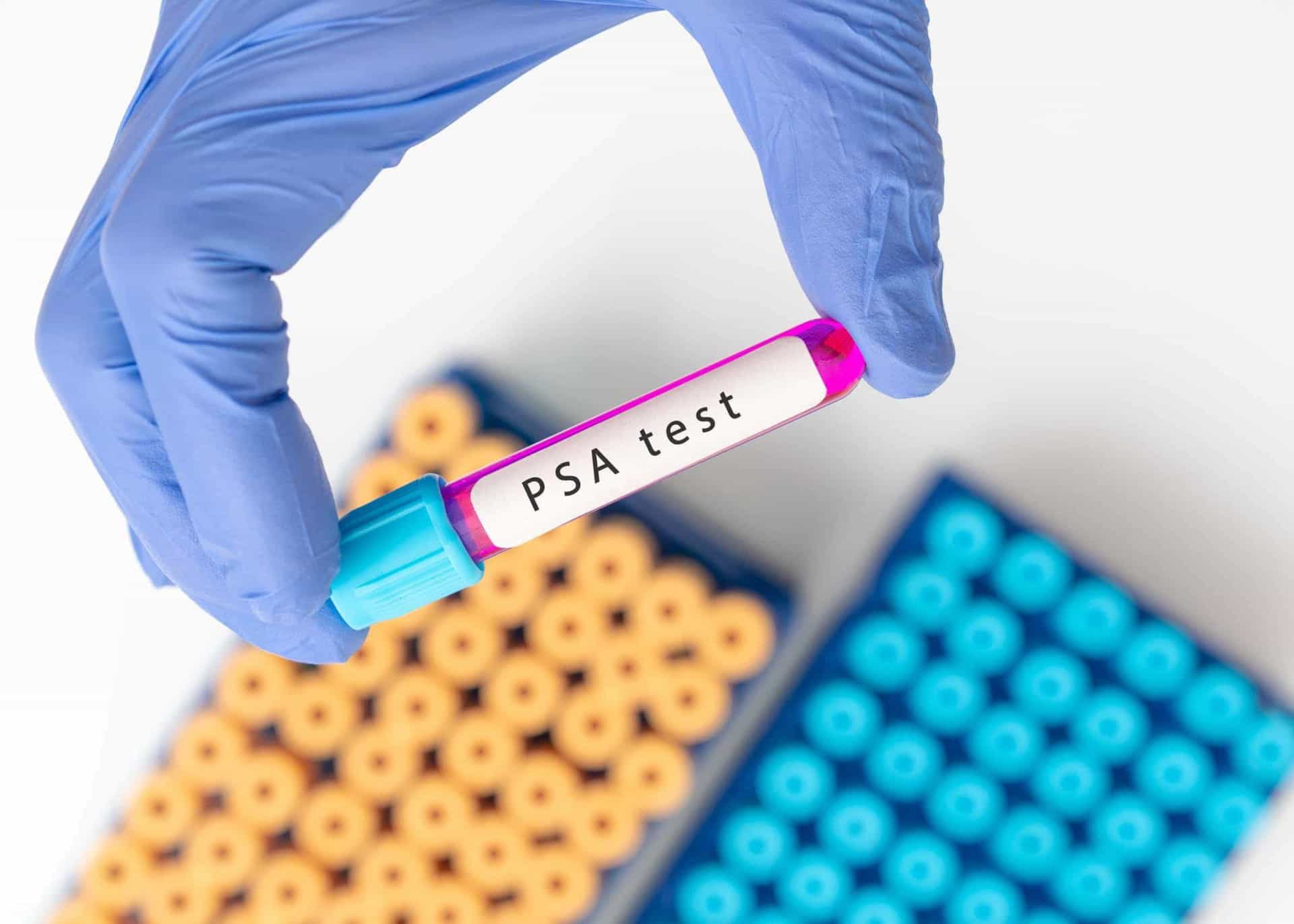 <p>The screening for prostate cancer is usually done in two ways: through a prostate-specific antigen (PSA) blood test, and using a digital rectal exam.</p><p>You may also like:<a href="https://www.starsinsider.com/n/468124?utm_source=msn.com&utm_medium=display&utm_campaign=referral_description&utm_content=516289en-en"> Celebs give their thoughts on the keto diet</a></p>