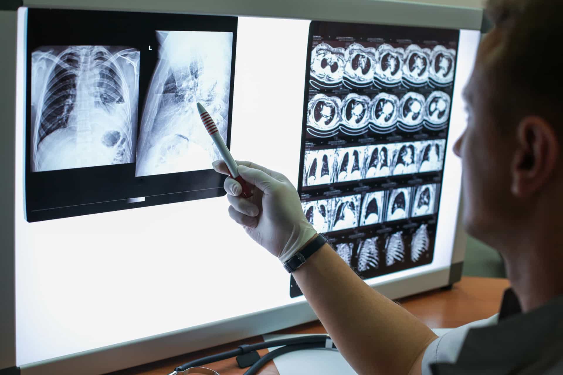 <p>There is a specific type of CT scan that is used to screen for lung cancer. It’s called a low-dose helical computed tomography.</p><p>You may also like:<a href="https://www.starsinsider.com/n/347016?utm_source=msn.com&utm_medium=display&utm_campaign=referral_description&utm_content=516289en-us"> Ridiculous things that only happen in Hollywood movies</a></p>
