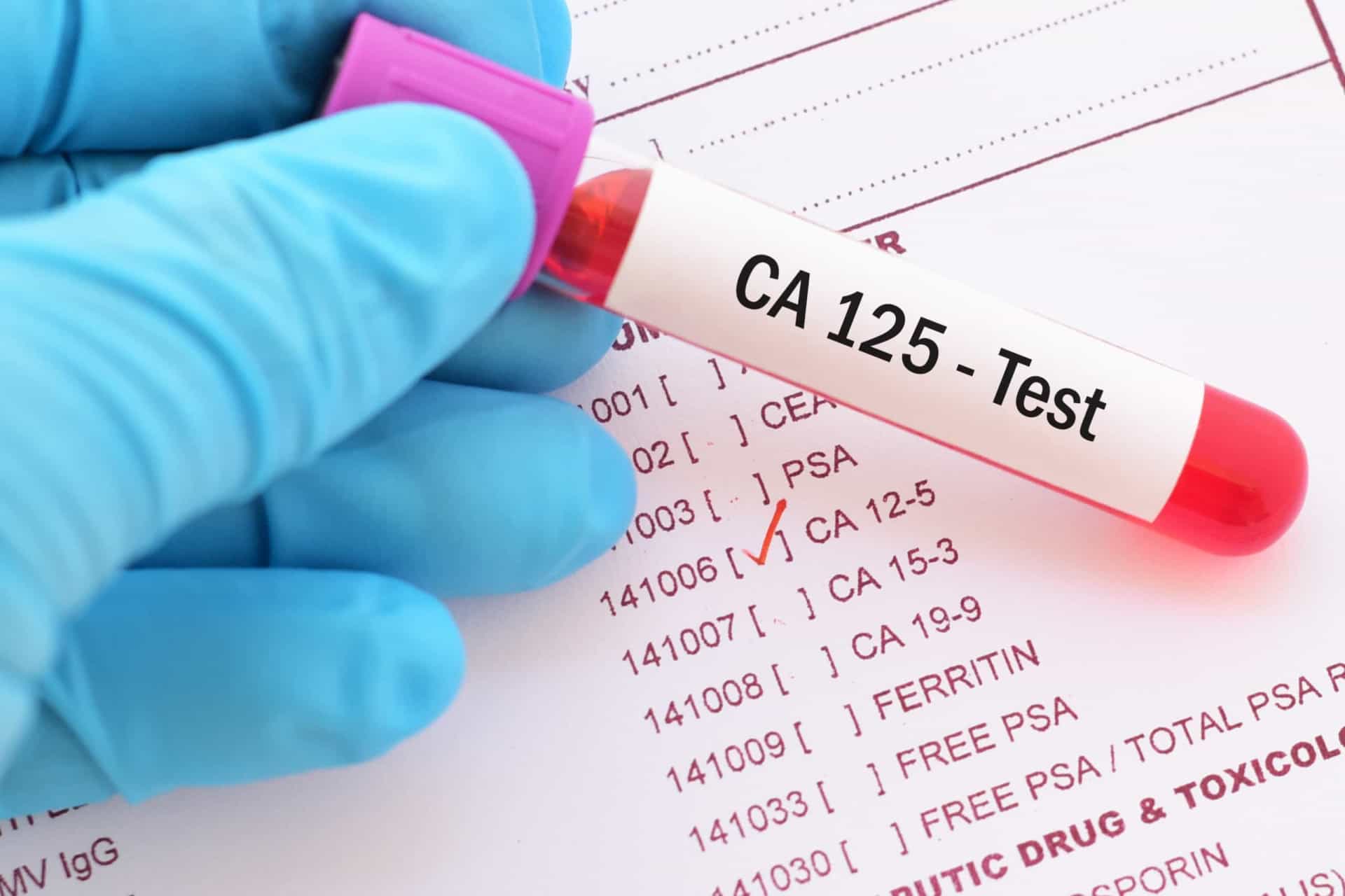 <p>This type of cancer is often diagnosed using two screening tests. These are a CA-125 blood test, and a transvaginal ultrasound.</p><p>You may also like:<a href="https://www.starsinsider.com/n/459958?utm_source=msn.com&utm_medium=display&utm_campaign=referral_description&utm_content=516289en-us"> Signs you were raised by helicopter parents</a></p>