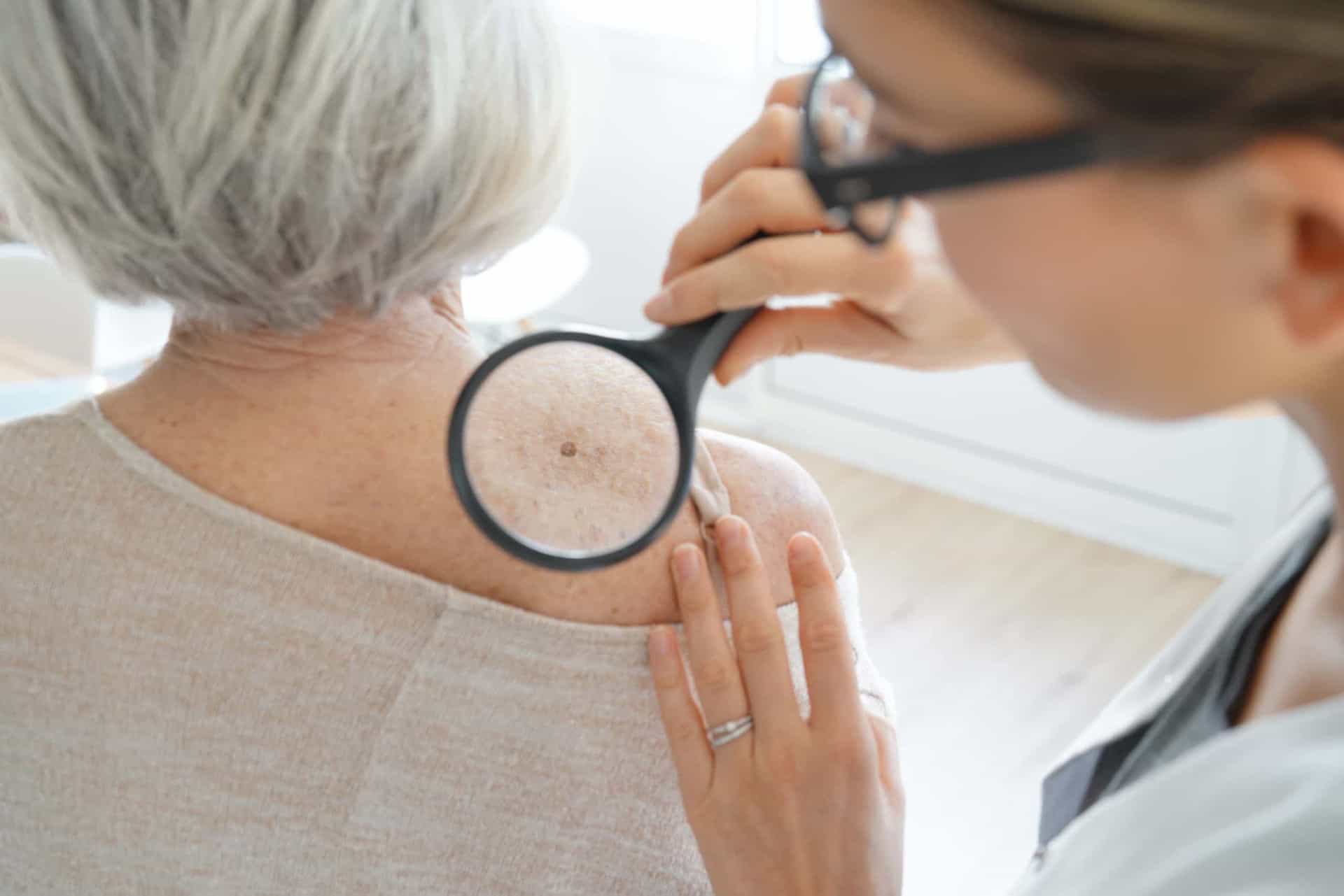 <p>It is important to tell your doctor if a new mole appears, or if you notice any changes on an existing mole.</p><p>You may also like:<a href="https://www.starsinsider.com/n/475071?utm_source=msn.com&utm_medium=display&utm_campaign=referral_description&utm_content=516289en-us"> Hollywood scandals that history forgot</a></p>