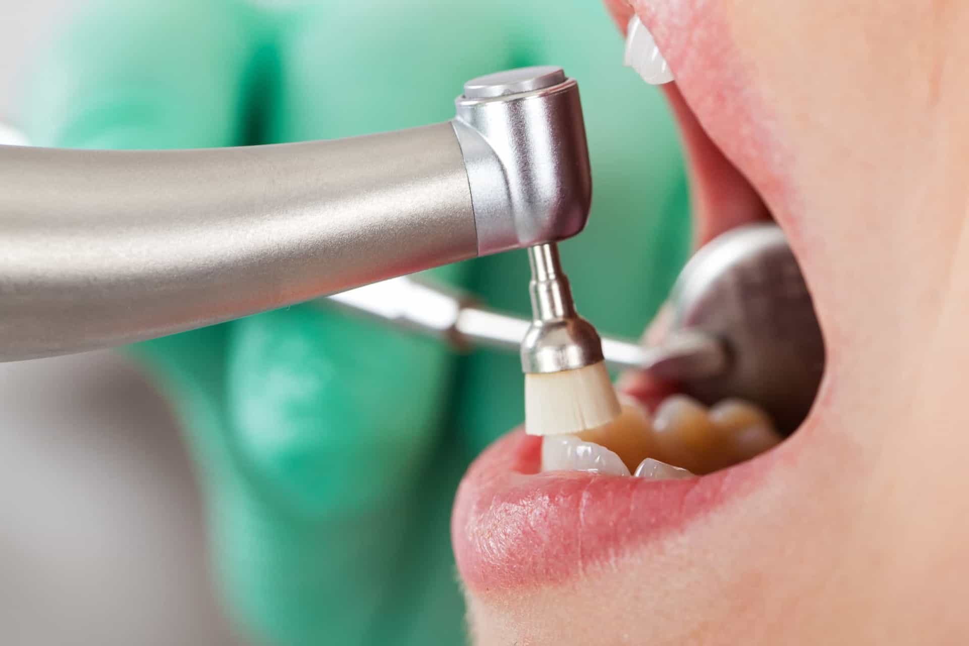 <p>“This will prevent food debris from lodging in your teeth, which can irritate you during a cleaning and give your dentist a little extra work to do," says doctor of dental surgery Gregory Skeens.</p><p><a href="https://www.msn.com/en-us/community/channel/vid-7xx8mnucu55yw63we9va2gwr7uihbxwc68fxqp25x6tg4ftibpra?cvid=94631541bc0f4f89bfd59158d696ad7e">Follow us and access great exclusive content everyday</a></p>