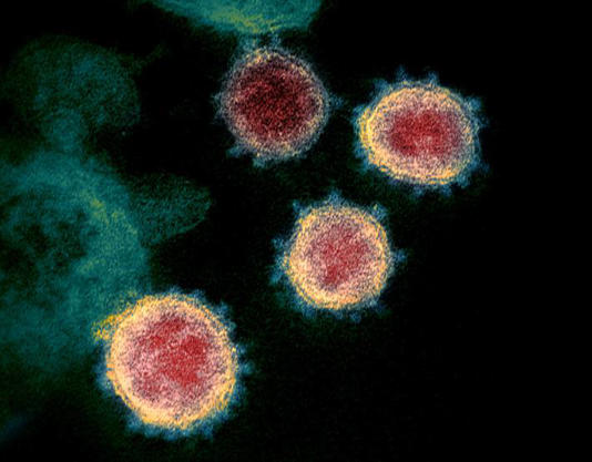 Imagem de microscópio mostra vírus SARS-CoV-2, da covid-19 Foto: NIAD-RML/Reuters