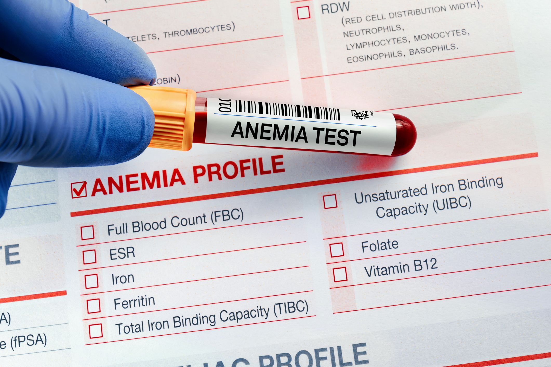 <p><a href="https://www.mayoclinic.org/diseases-conditions/vitamin-deficiency-anemia/symptoms-causes/syc-20355025">Anemia symptoms</a> include fatigue, shortness of breath, dizziness, irregular heartbeat, muscle weakness, pale skin, and numbness in extremities. The cause is unhealthy red blood cells that are too large and don’t carry oxygen as efficiently as they should. Red blood cell development requires vitamin B12 and folate, which can be added to your diet through supplements.</p>
