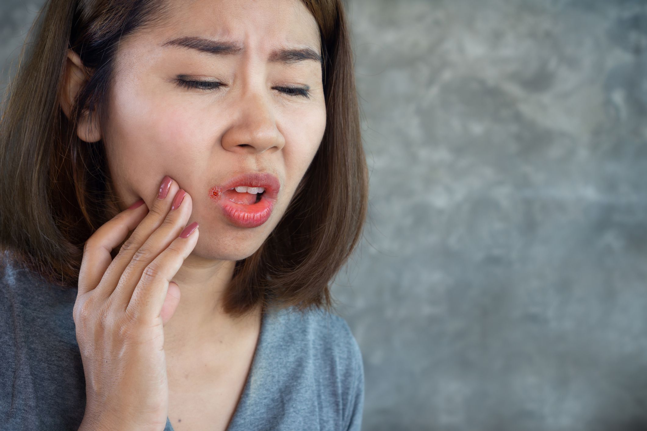 <p>Canker sores and other mouth ulcers also could be linked to <a href="https://www.ncbi.nlm.nih.gov/pubmed/3165514/">iron deficiency</a>, or low levels of B vitamins. Twenty-eight percent of patients with mouth sores had <a href="https://www.ncbi.nlm.nih.gov/pmc/articles/PMC3576783/">B1, B2, or B6 deficiencies</a> according to one study.</p><p>Just like the previous section, you can improve your levels of these vitamins and minerals with meat, poultry, fish, beans, nuts, seeds and whole grains. A diet full of these foods can help assuage many nutrient shortages, so keep that in mind. The <a href="https://ods.od.nih.gov/factsheets/Riboflavin-HealthProfessional/">B vitamins</a> can be increased also with starchy vegetables and eggs.</p>