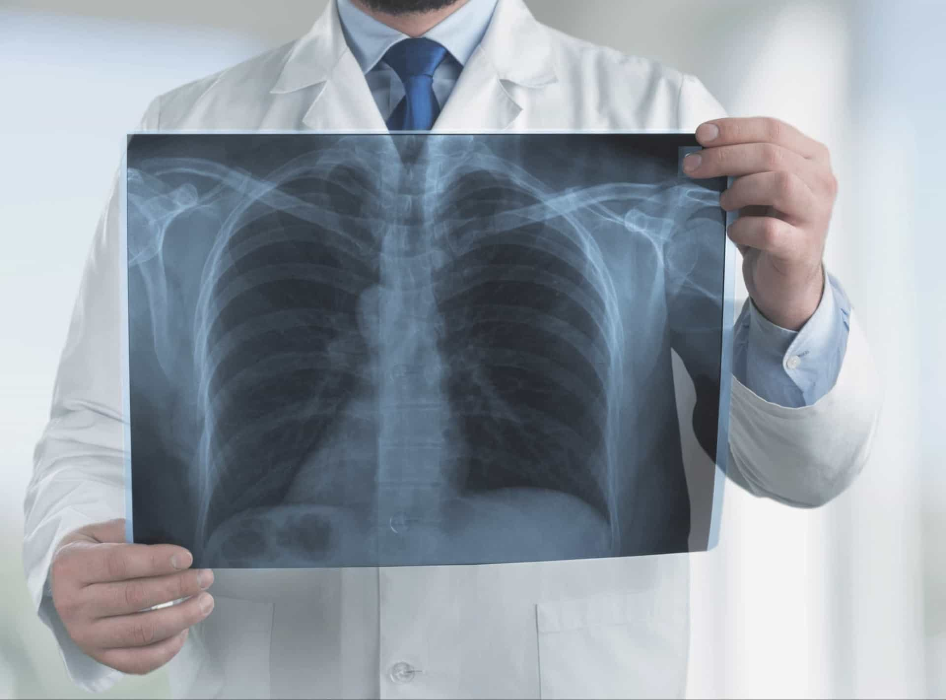 What Is Chronic Obstructive Pulmonary Disease?