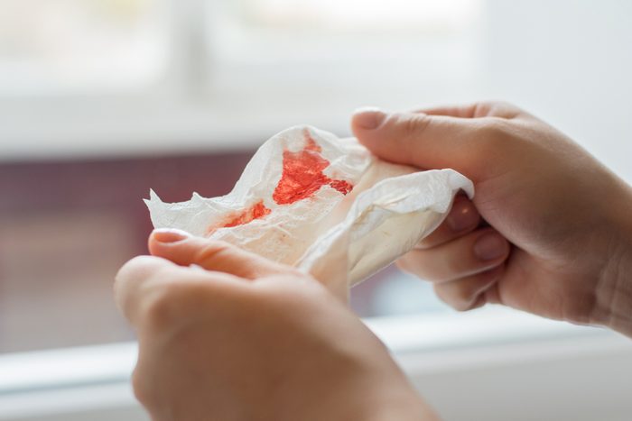 Photo of hands holding a paper napkin with blood