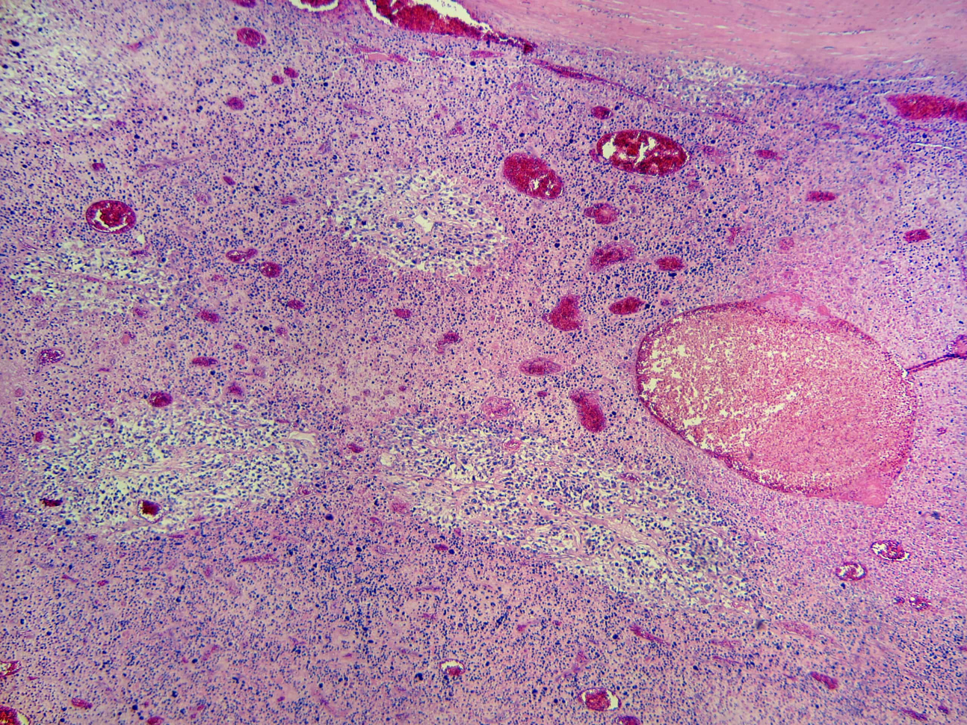 Rare cancers that challenge the medical profession