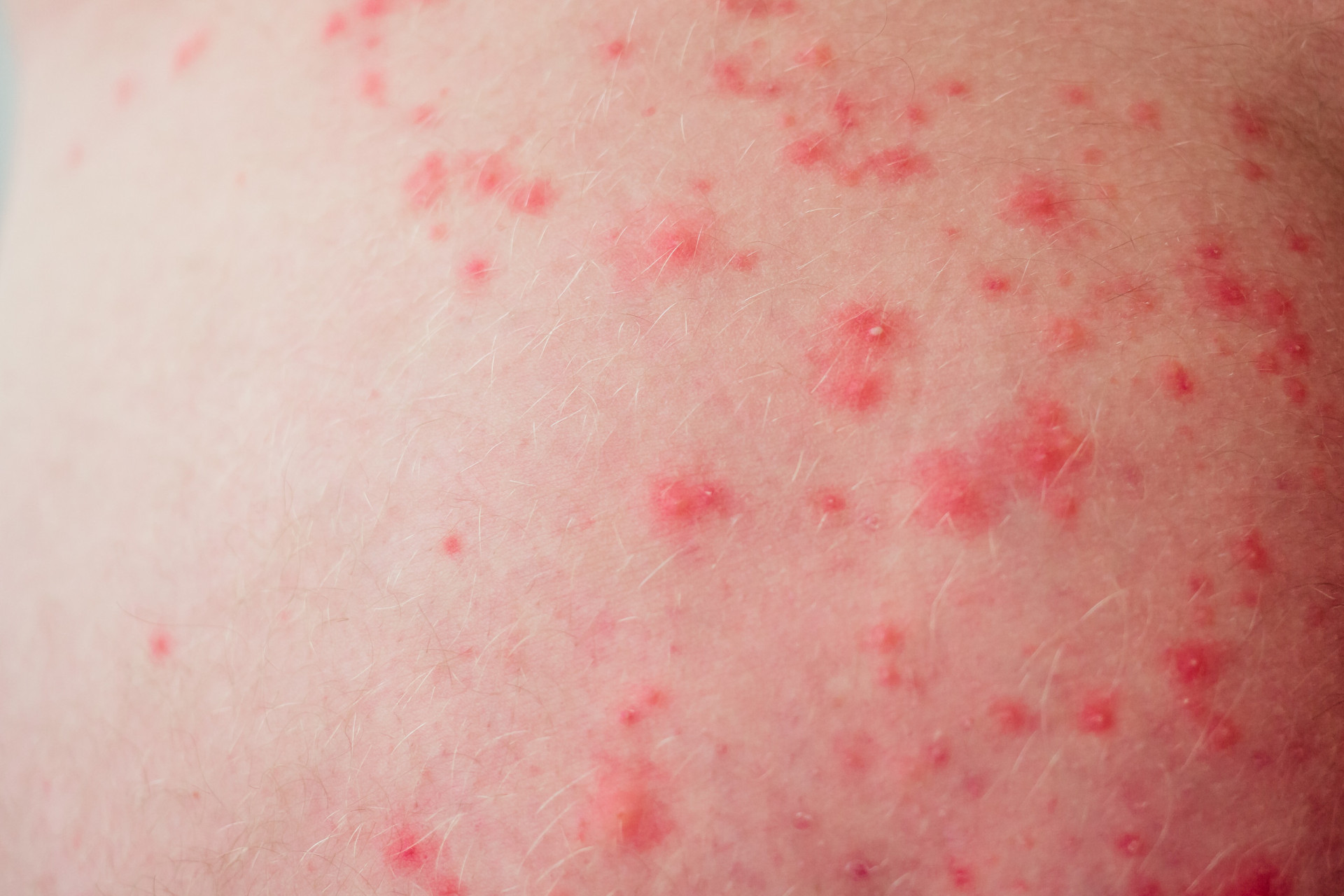 What happens to your body when you stop wearing underwear?