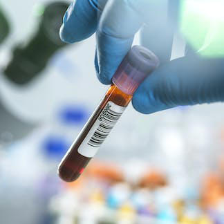 What Do Your Blood Test Results Mean? A Toxicologist Explains The 