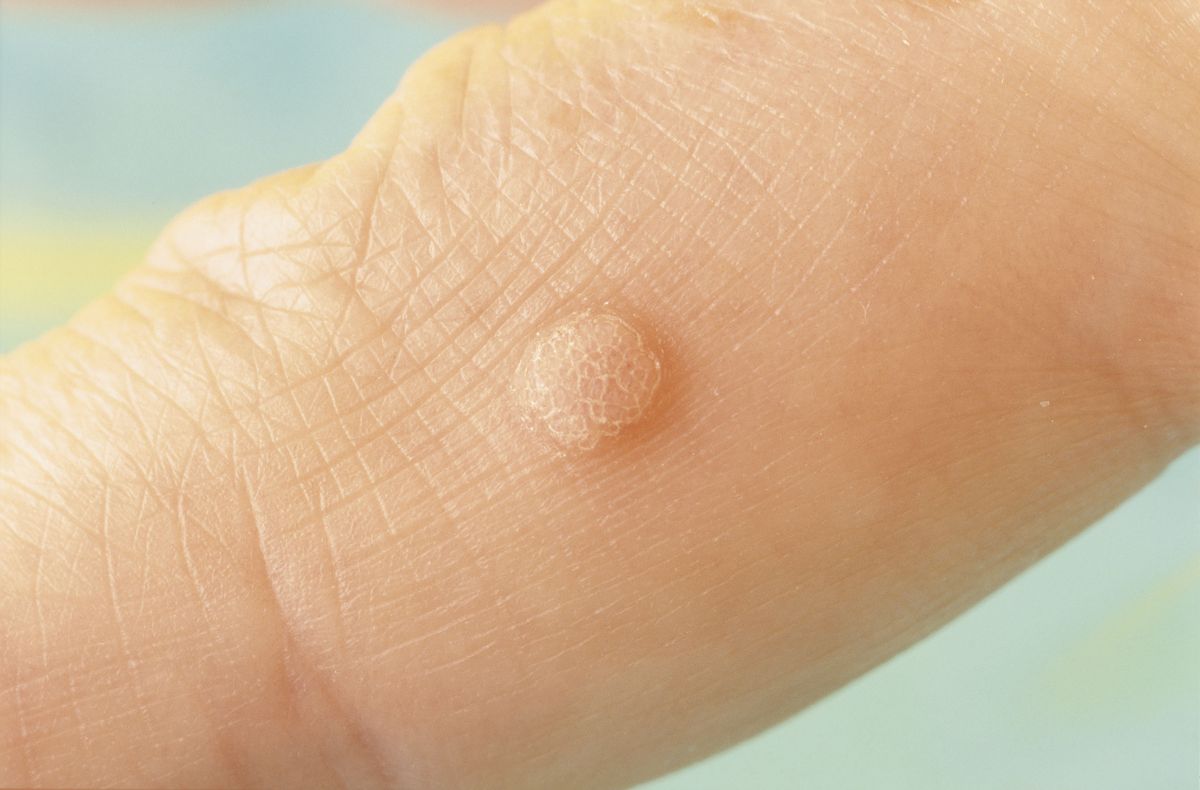 These Pictures Will Help You Identify the Most Common Skin Rashes