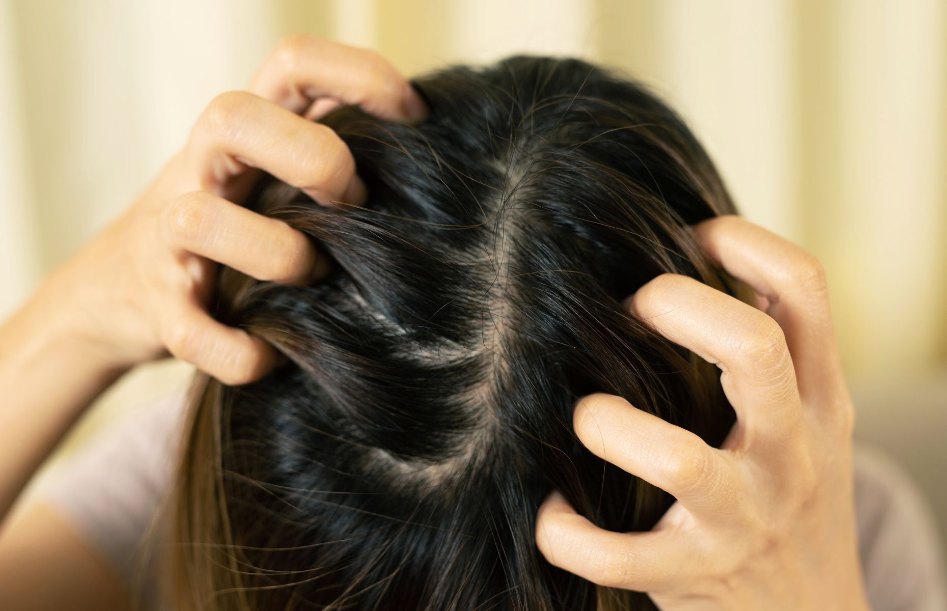 Alopecia Causes, symptoms and treatments