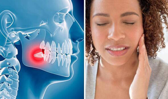 Is your wisdom tooth coming through?
