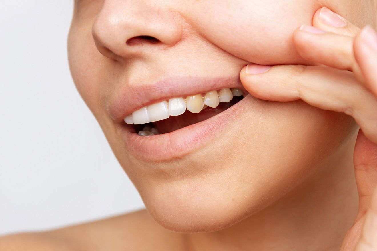 remedios caseros para ‘barrer’ las manchas amarillas de los dientes
