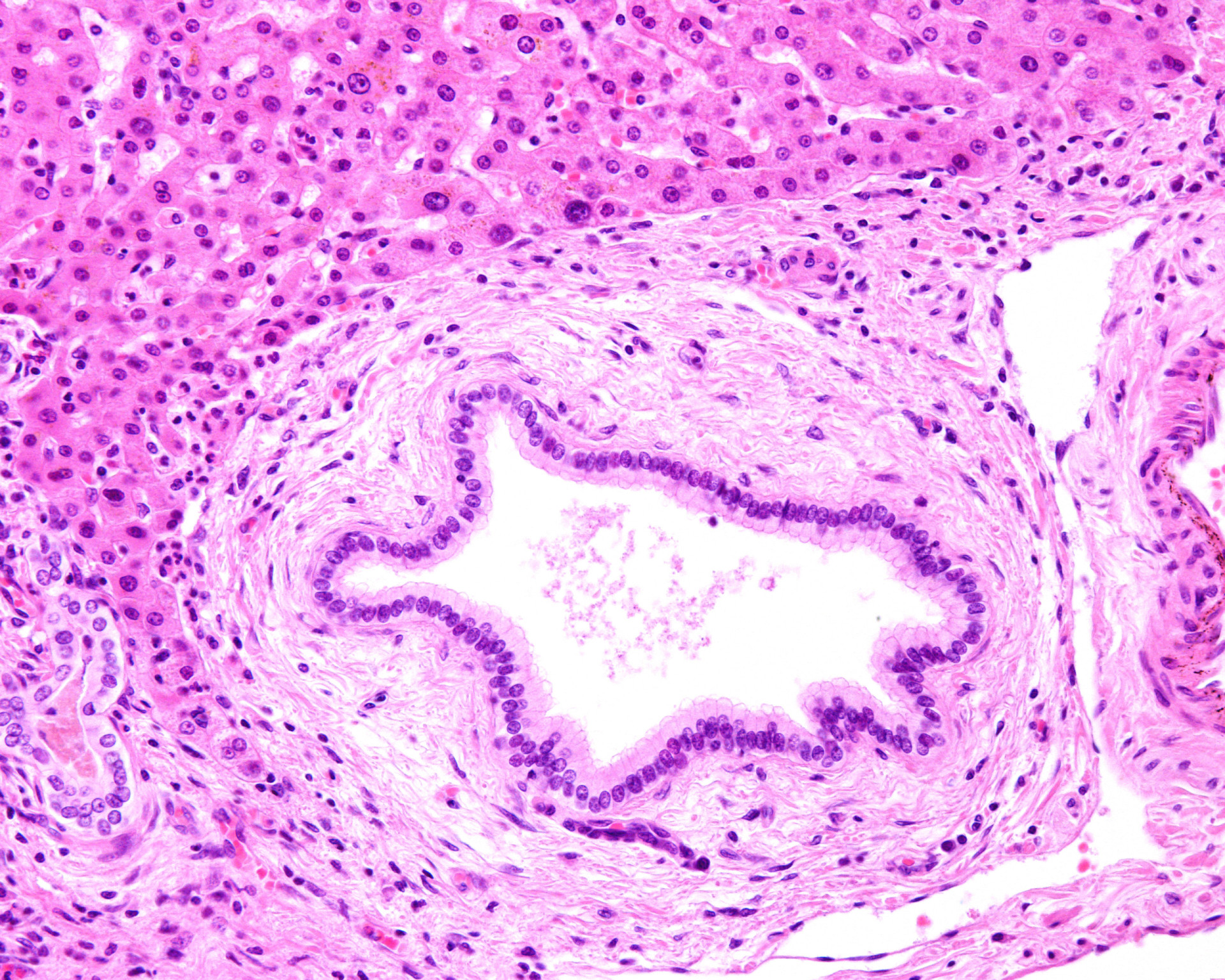 Is Ox Bile The Cancer Trigger You'Ve Been Overlooking? - 8p64i0m