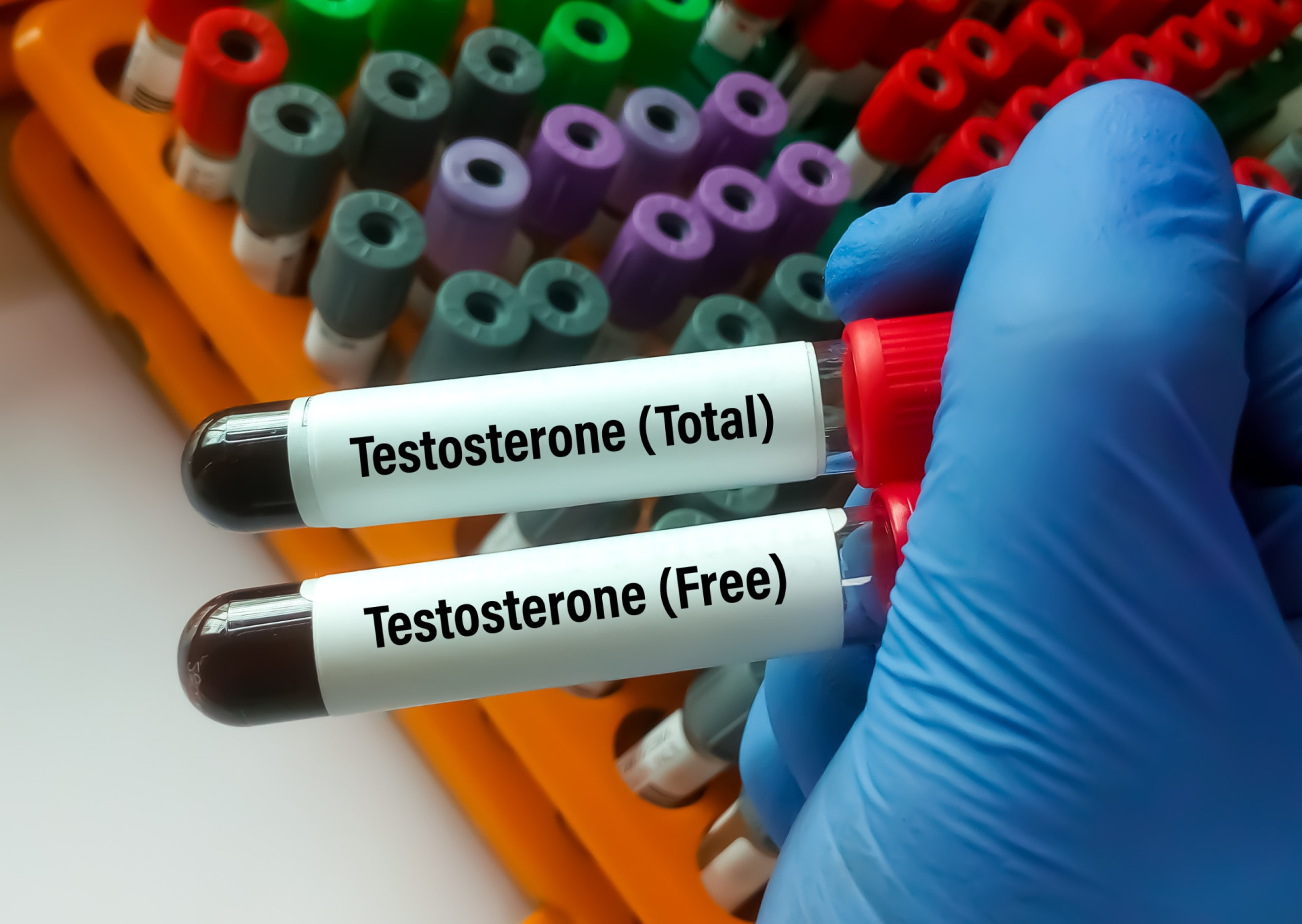 Veja O Que Fazer Para Aumentar A Testosterona De Forma Natural