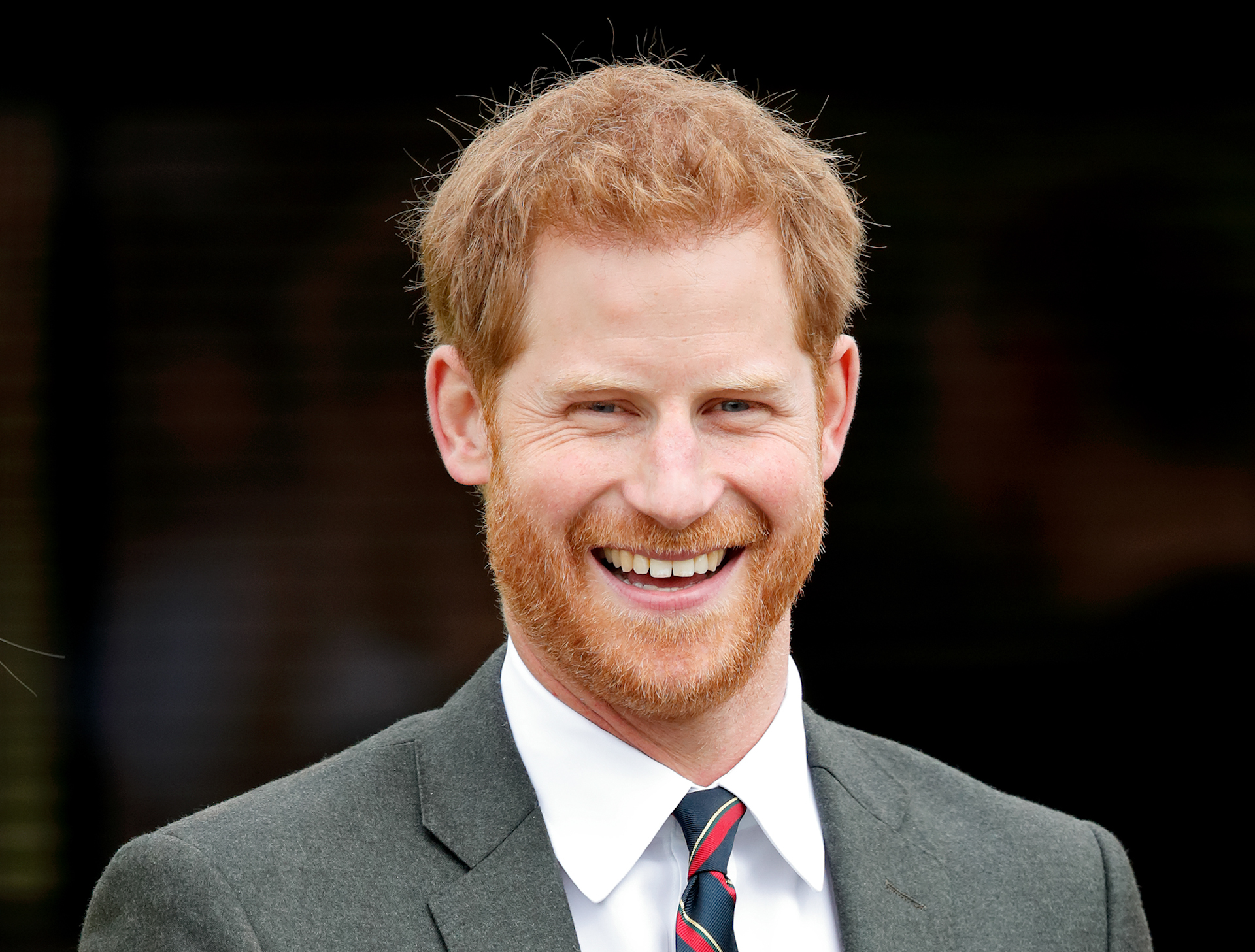 Prince Harry creates boost in beard transplants